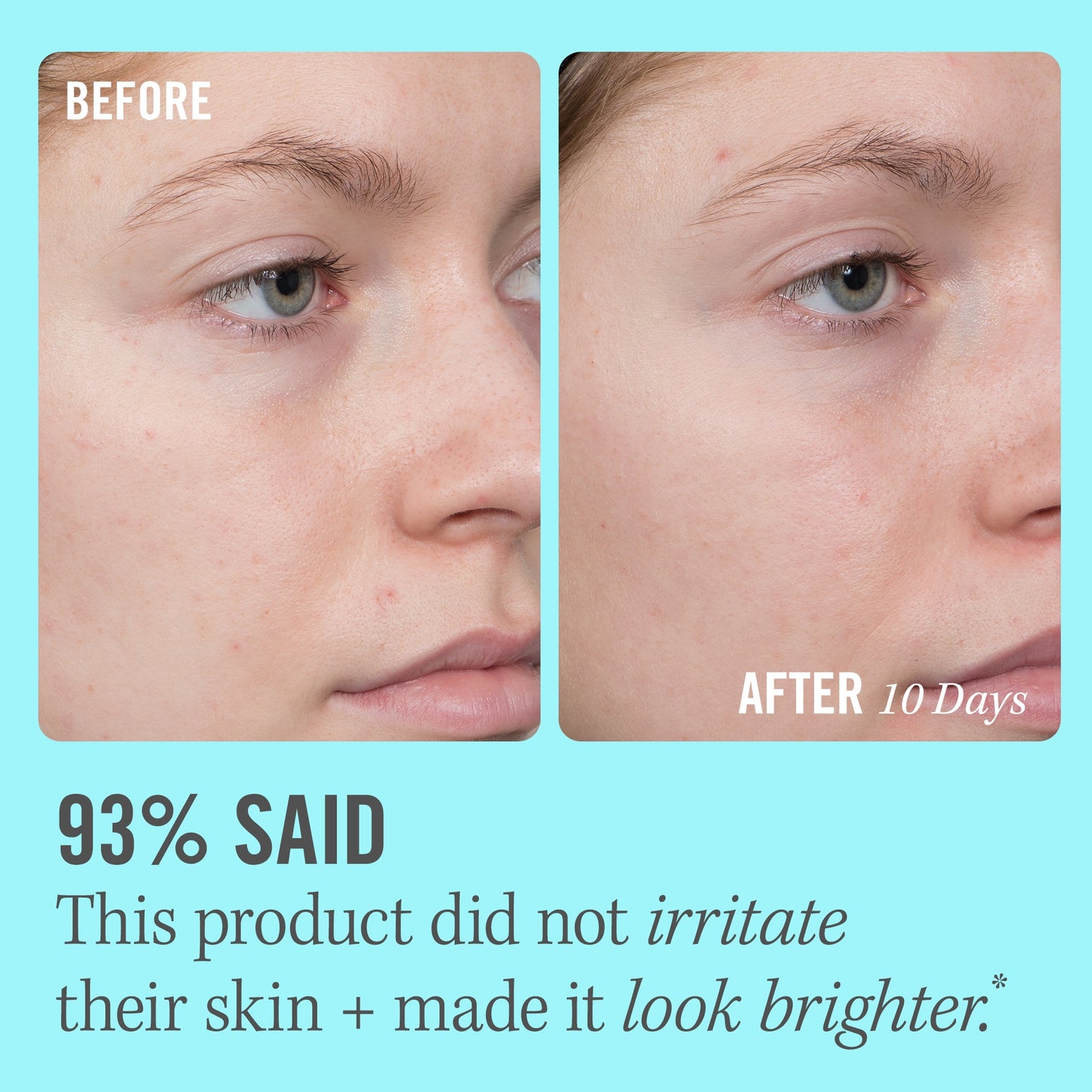 First Aid Beauty 10% Vitamin C Brightening Serum 1.7 oz