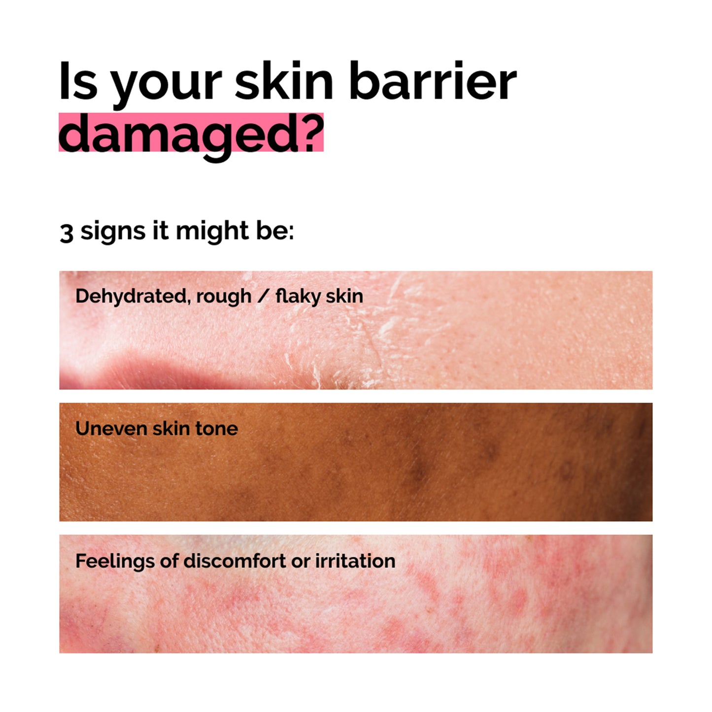 The Ordinary Soothing & Barrier Support Serum 30ml