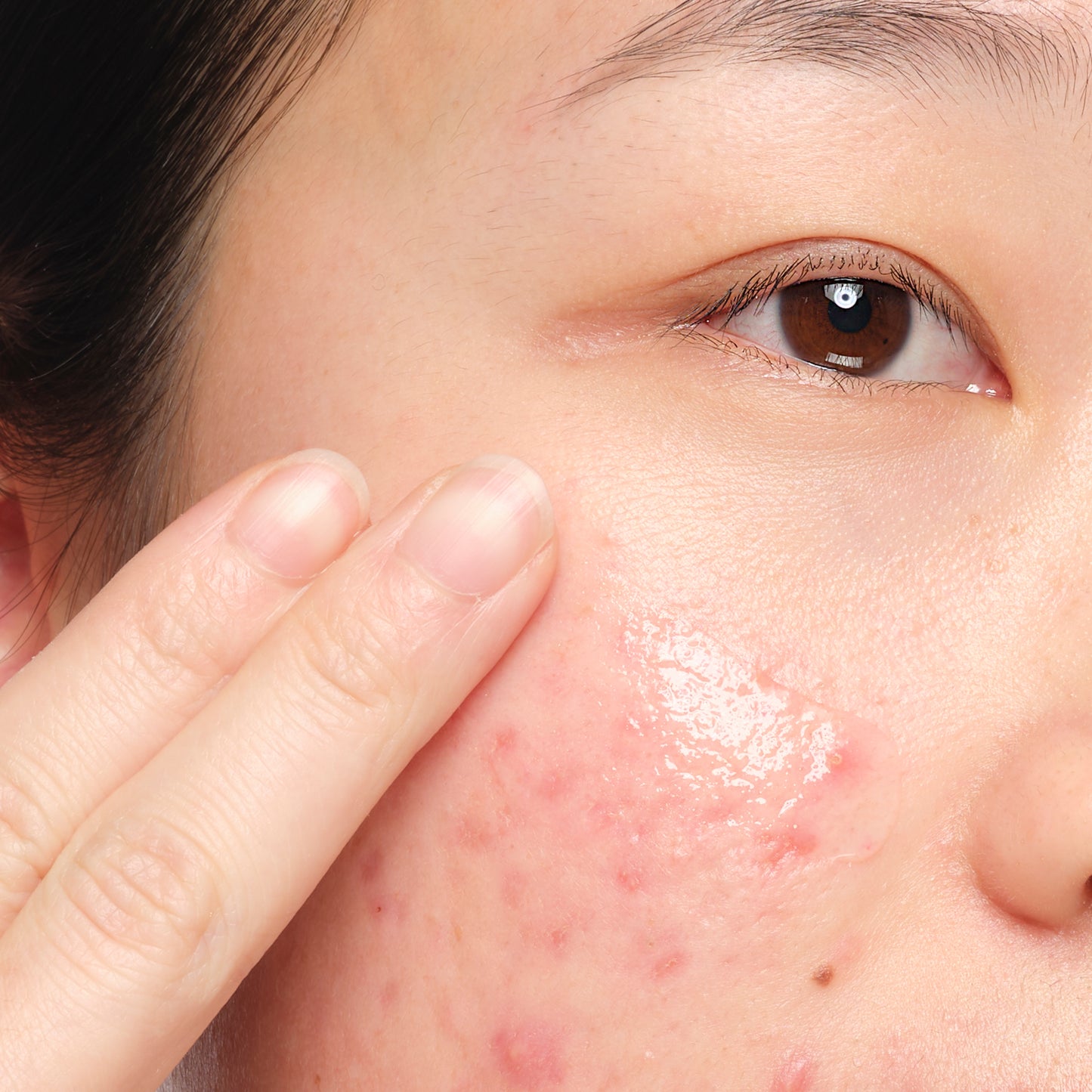 The Ordinary Aloe 2% + NAG 2% 30ml