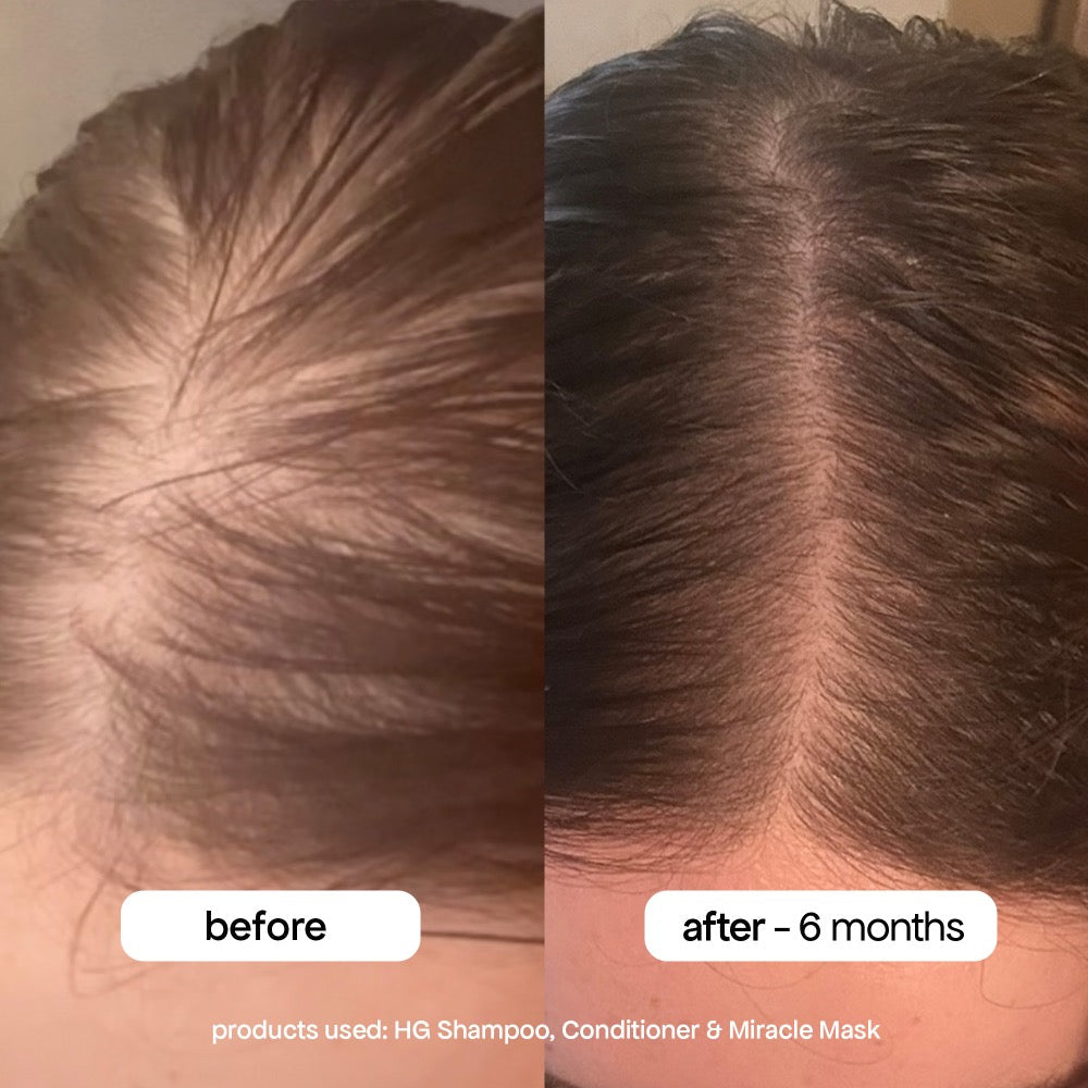 Bondi Boost HG Miracle Hair Mask 250ml