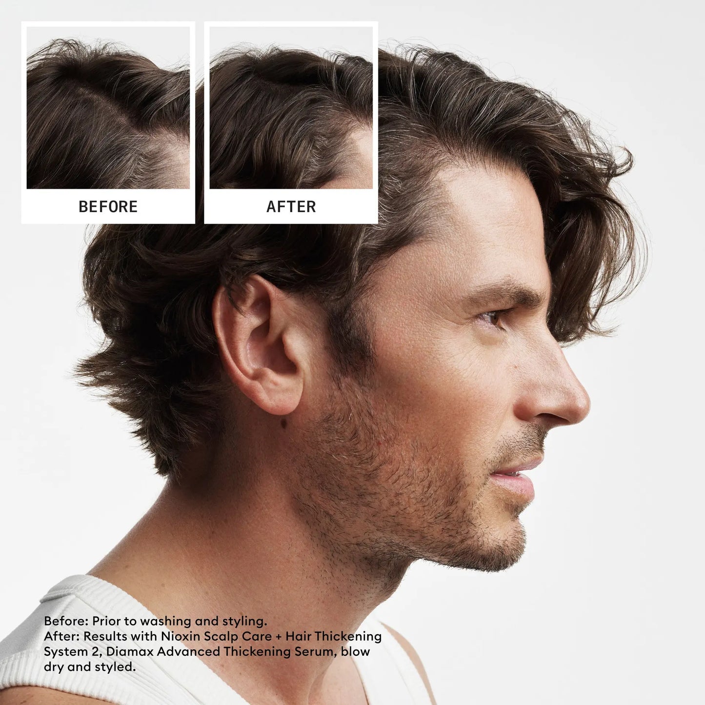 Nioxin Scalp + Hair Thickening System 2 Trial Kit