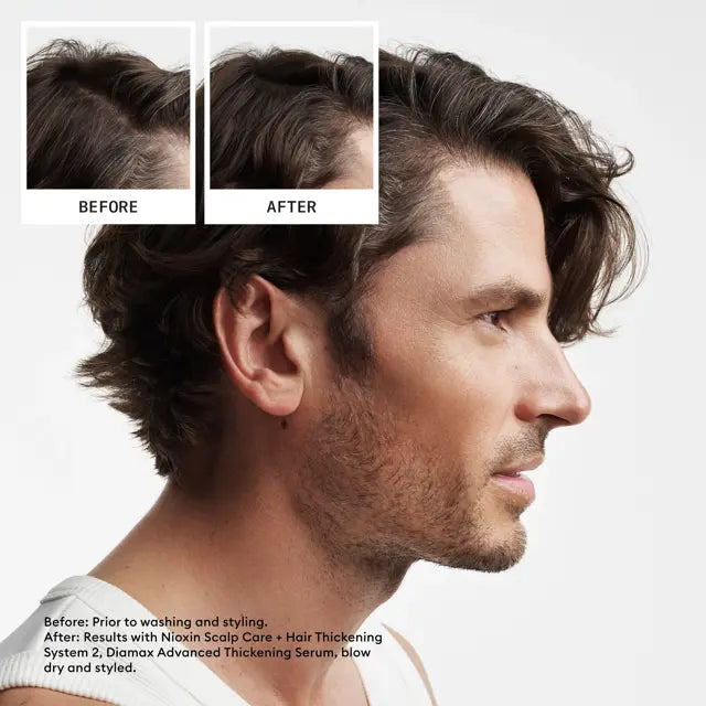 Nioxin Scalp + Hair Thickening System 2 Full Size Kit