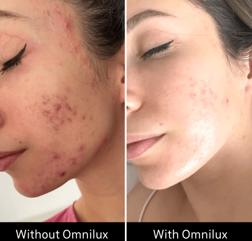 Omnilux Omnilux Clear LED Light Therapy