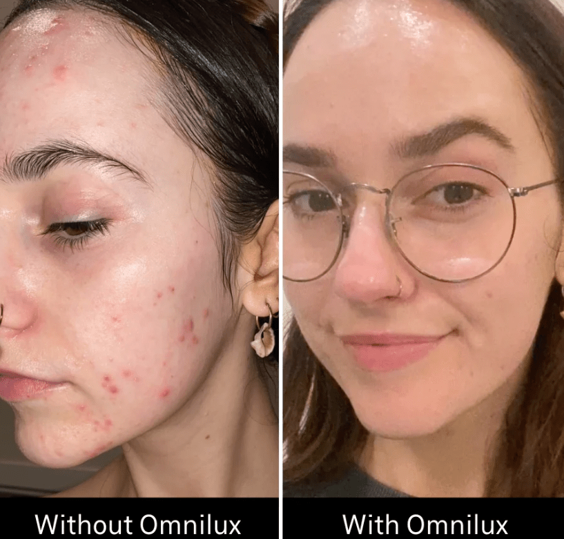 Omnilux Omnilux Clear LED Light Therapy