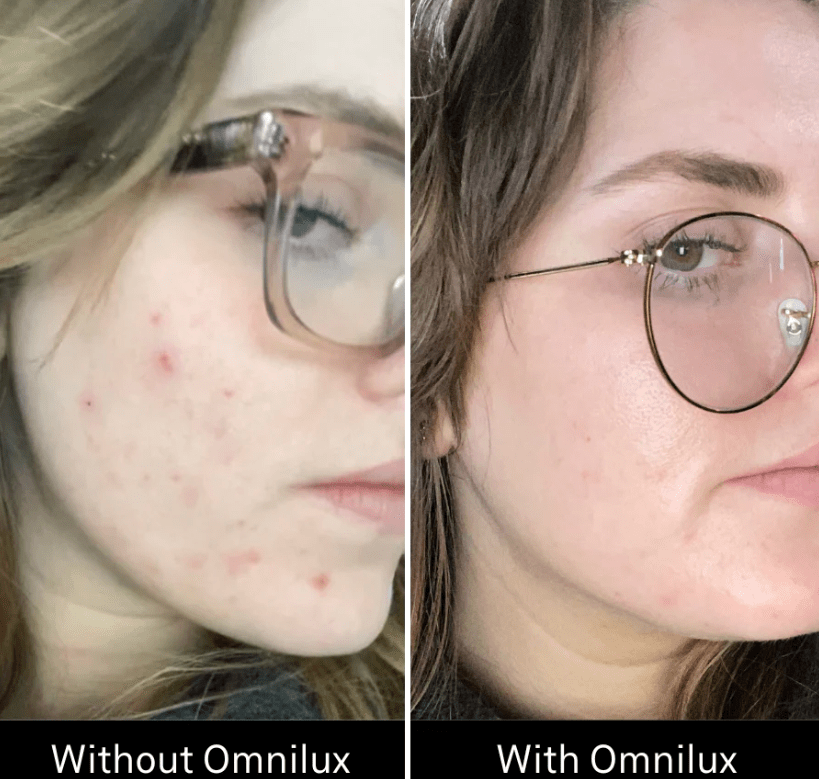 Omnilux Omnilux Clear LED Light Therapy