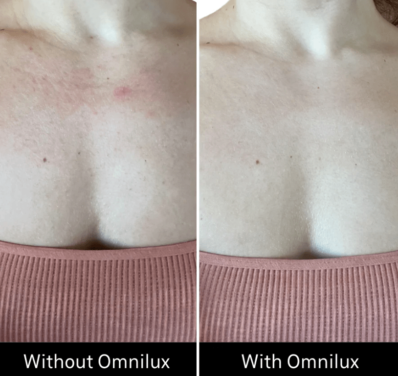Omnilux Omnilux Contour Neck & Décolleté LED Light Therapy
