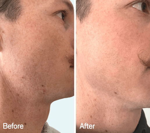 Omnilux Omnilux Men LED Light Therapy