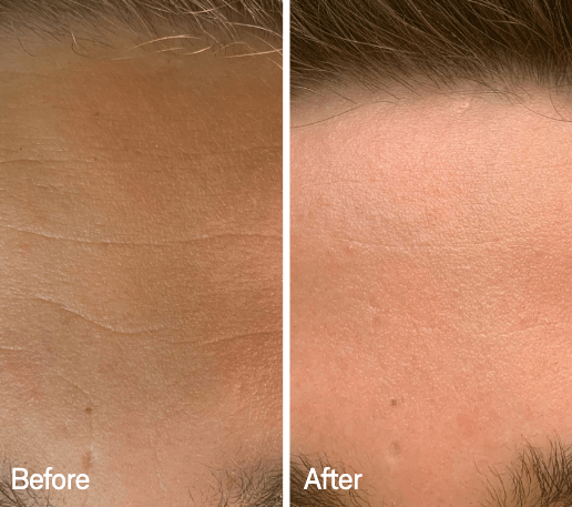 Omnilux Omnilux Men LED Light Therapy