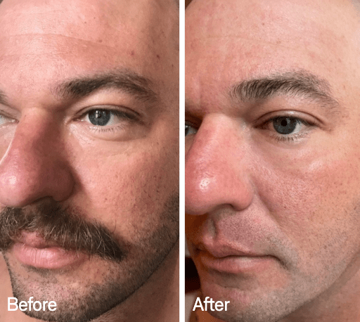 Omnilux Omnilux Men LED Light Therapy