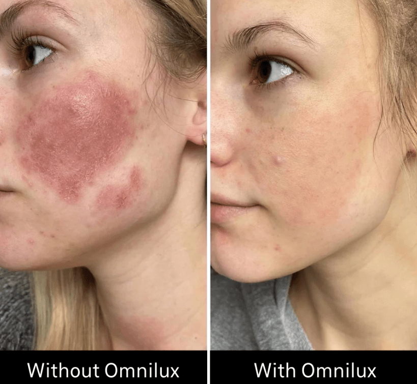 Omnilux Omnilux Contour Face