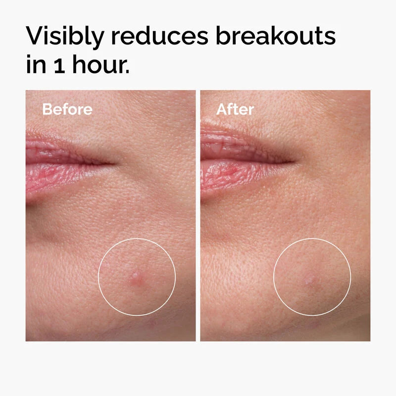 The Ordinary Sulfur 10% Powder-to-Cream Concentrate 5g