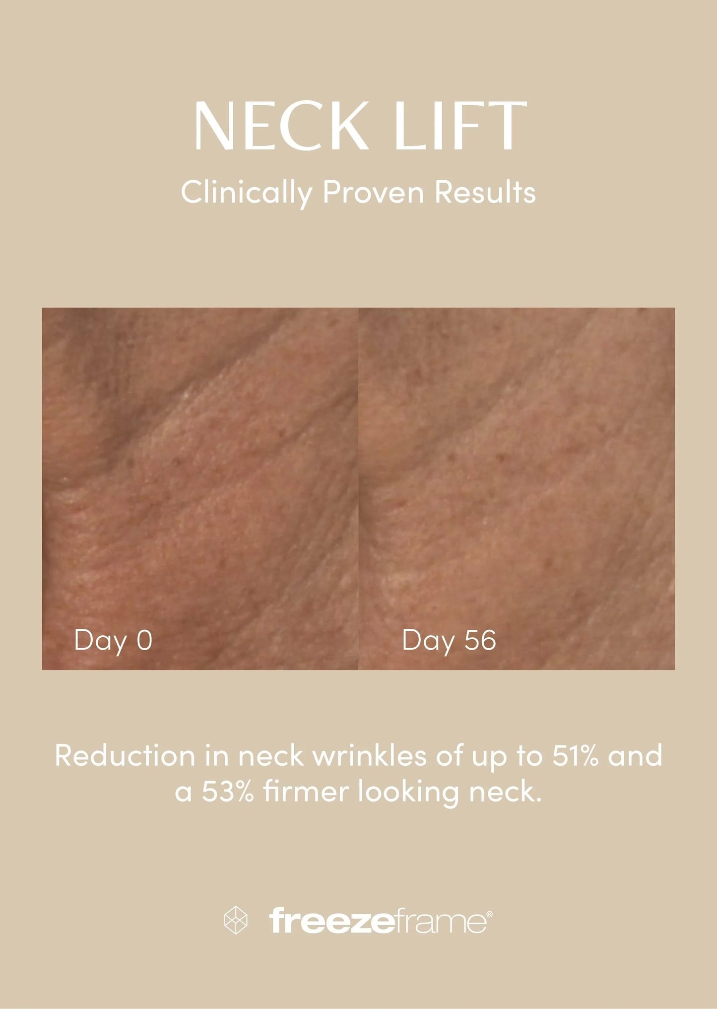 freezeframe Neck Lift 50ml