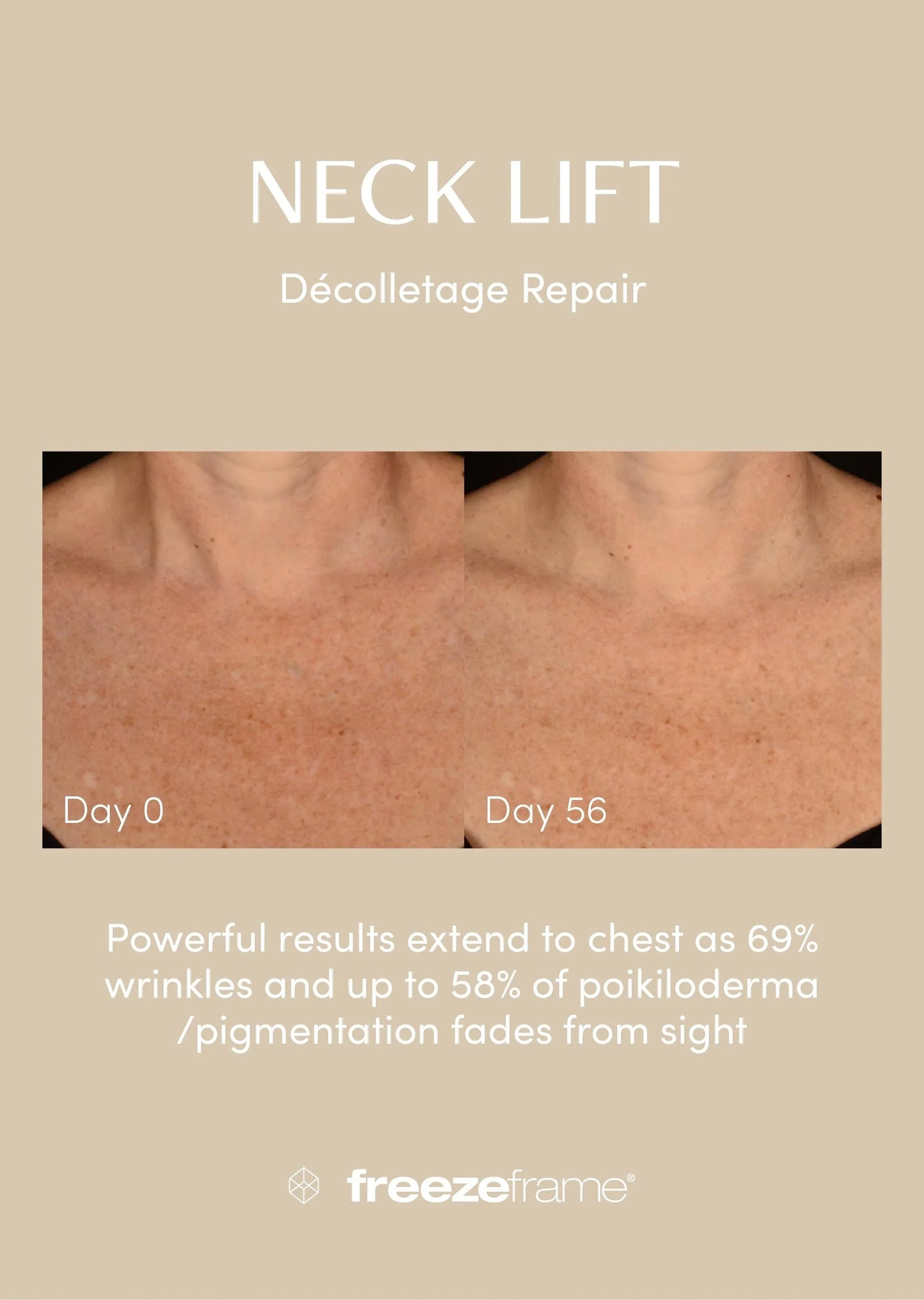 freezeframe Neck Lift 50ml