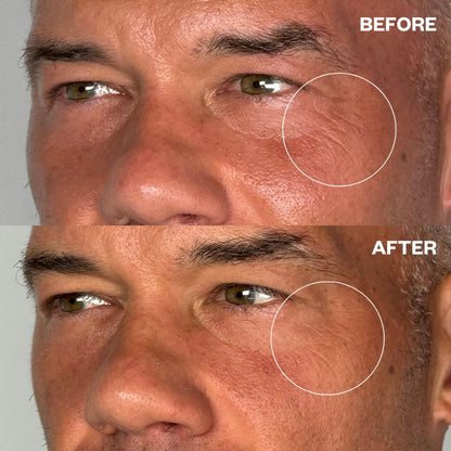 Wrinkles Schminkles Men's Pro Eye Wrinkle Patches - 3 Pairs
