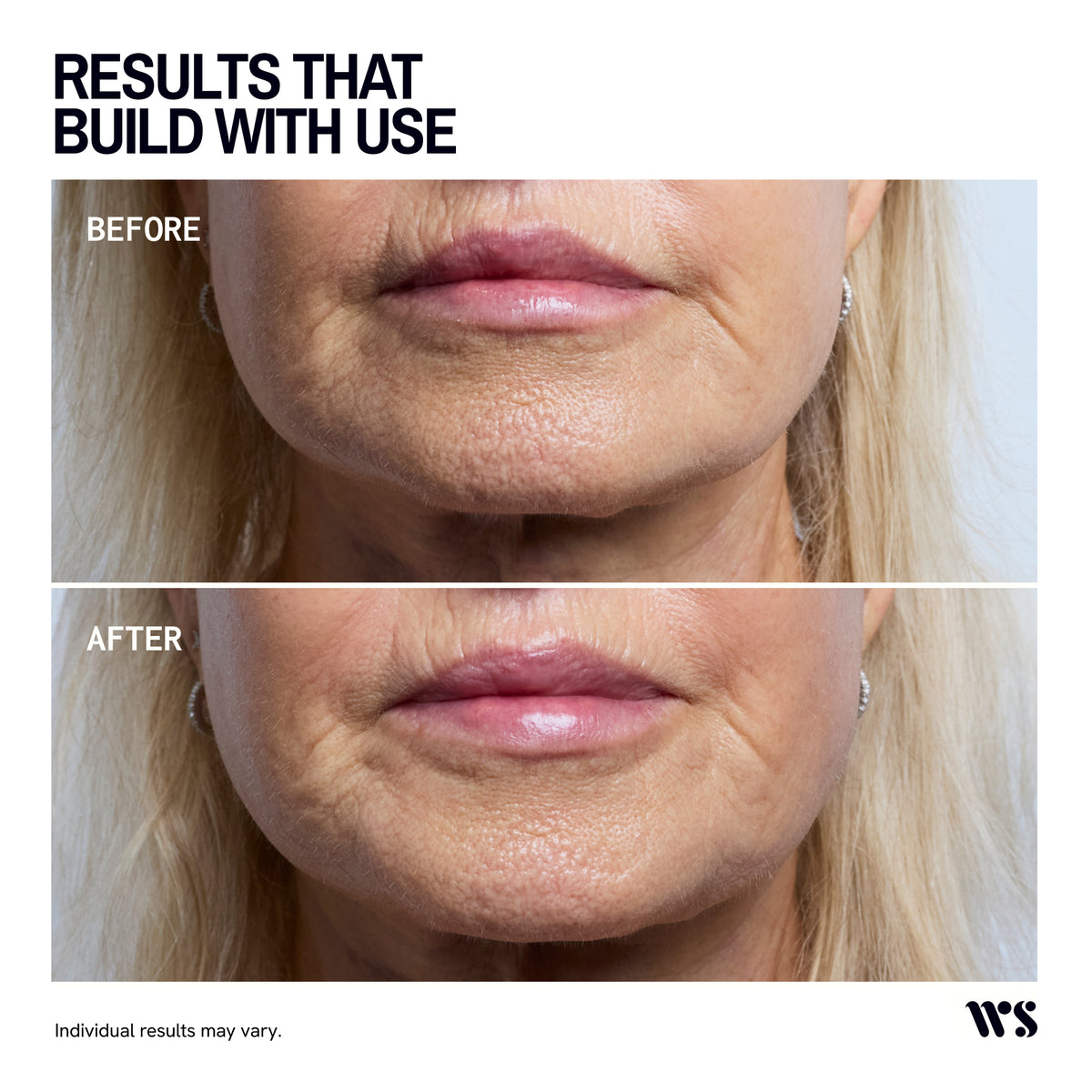 Wrinkles Schminkles Morning After Glow Serum 50ml