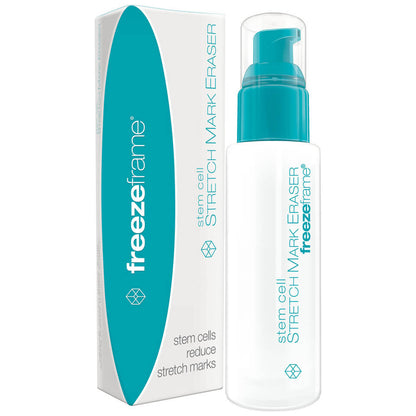 Freezeframe Stretch Mark Eraser 80ml