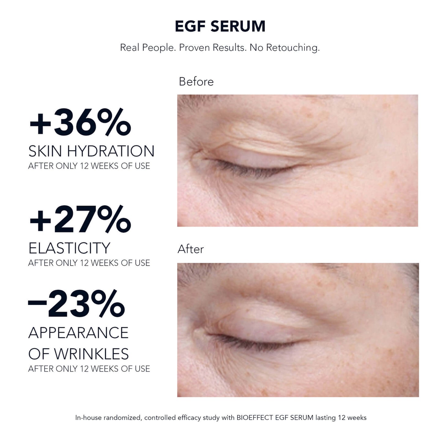 BIOEFFECT EGF Serum 15ml