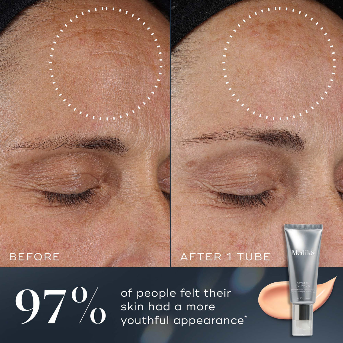 Medik8 Crystal Retinal 6 30ml - B&A