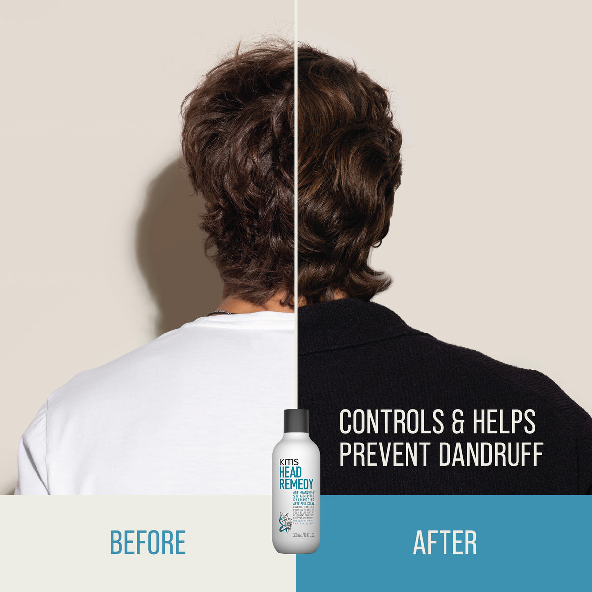 KMS Headremedy Anti-Dandruff Shampoo 300ml