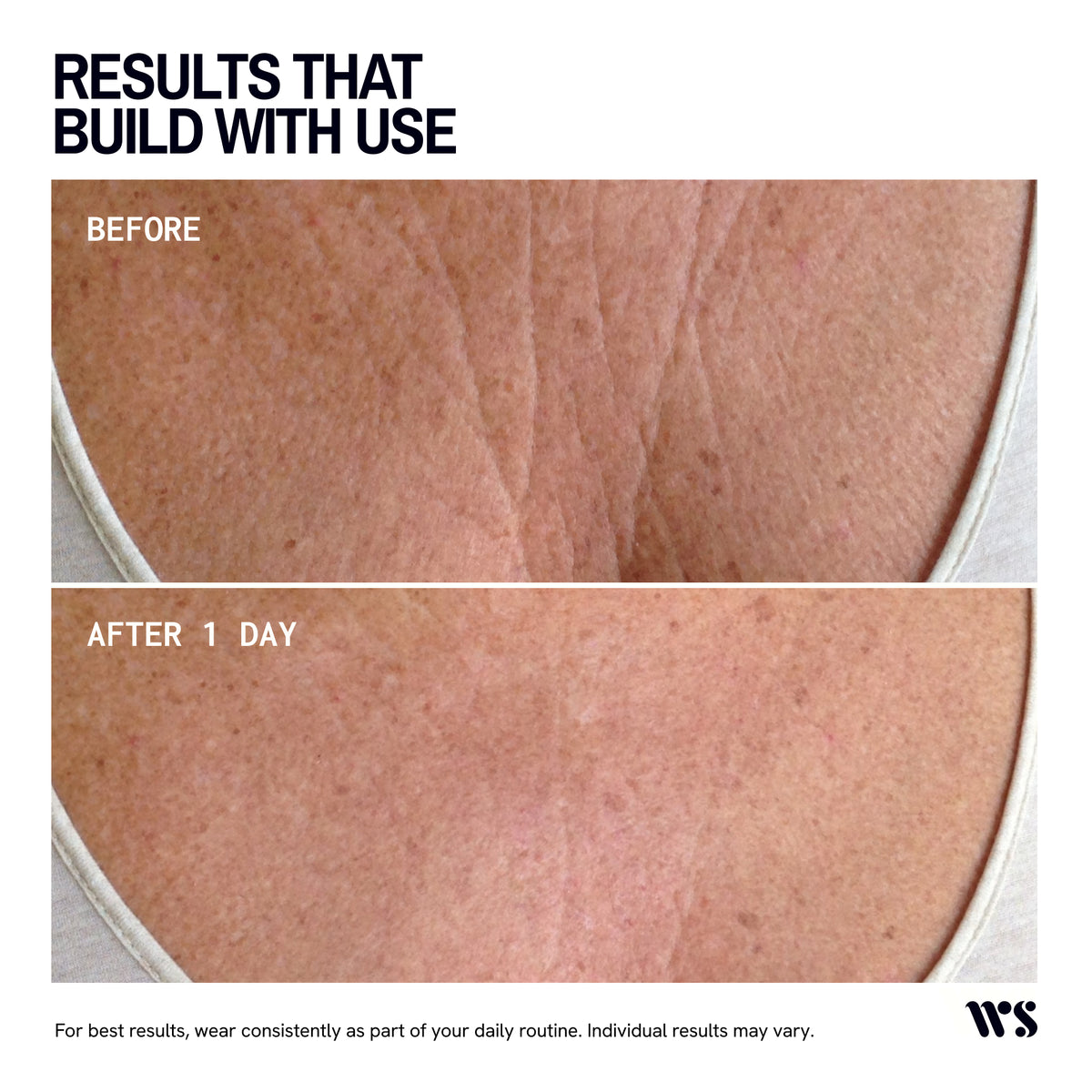 Wrinkles Schminkles Chest Wrinkle Patch