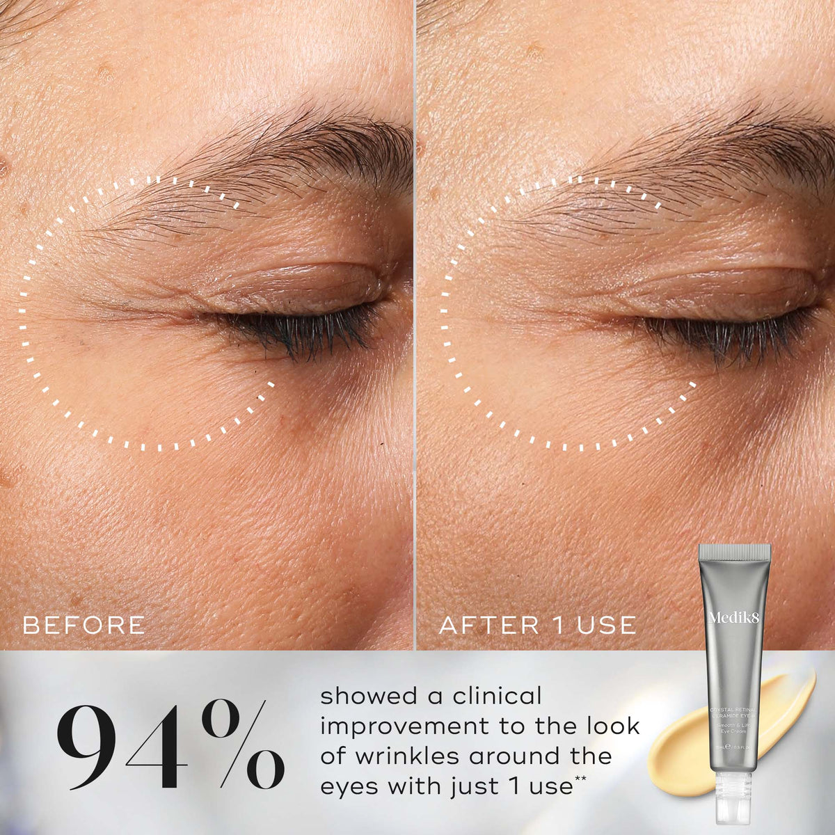 Medik8 Crystal Retinal Ceramide Eye 6 15ml - B&A