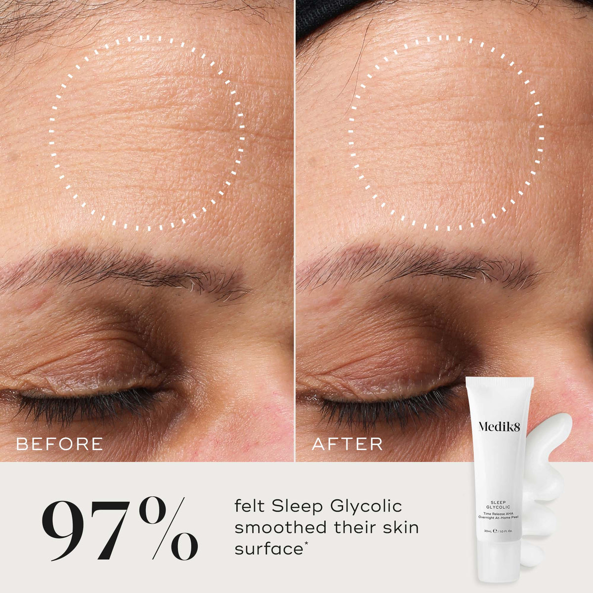Medik8 Sleep Glycolic 30ml - B&A