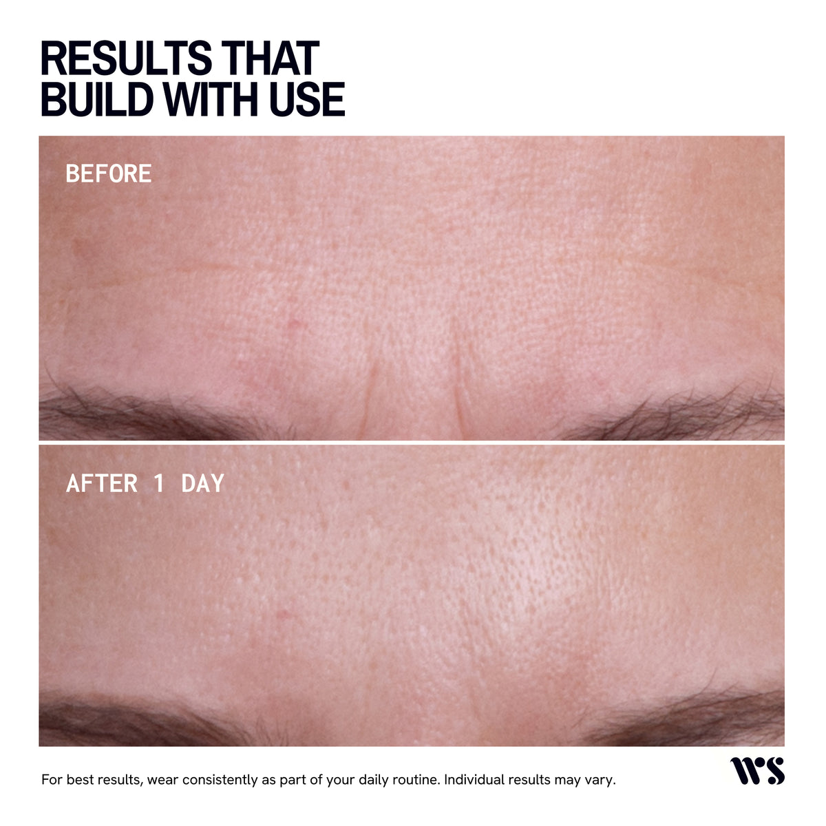 Wrinkles Schminkles Brow, Frown & Bunny Lines Wrinkle Patches - 2 Patches