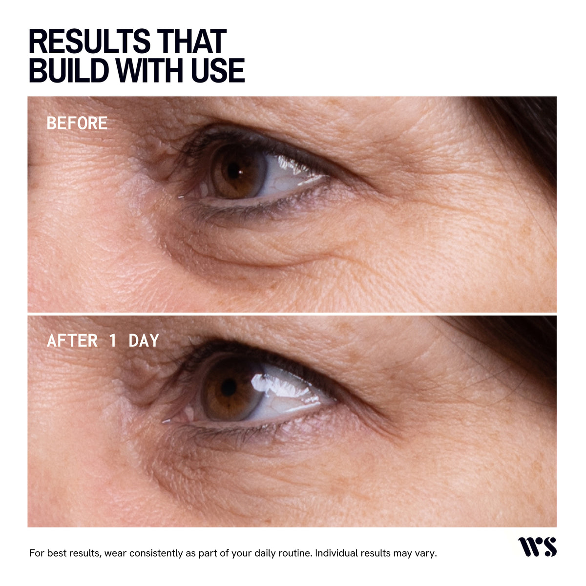 Wrinkles Schminkles Eye Wrinkles Patches - 3 Pairs