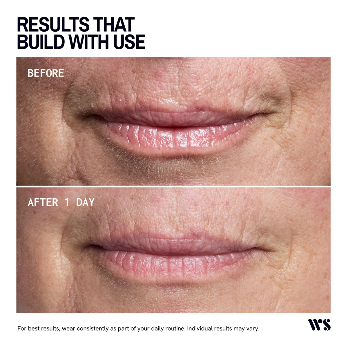 Wrinkles Schminkles Mouth and Lip Wrinkle Patch - 1 Patch