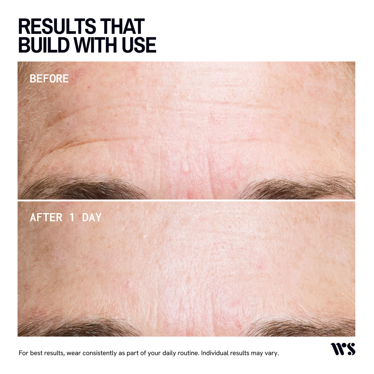 Wrinkles Schminkles Forehead Wrinkle Patches - 2 Patches