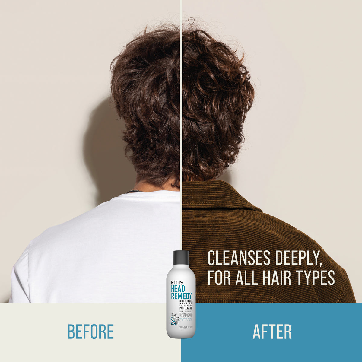 KMS Headremedy Deep Cleanse Shampoo 300ml