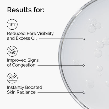 The Ordinary Niacinamide 10% + Zinc 1% 30ml