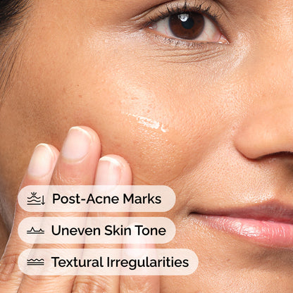 The Ordinary Aloe 2% + NAG 2% 30ml