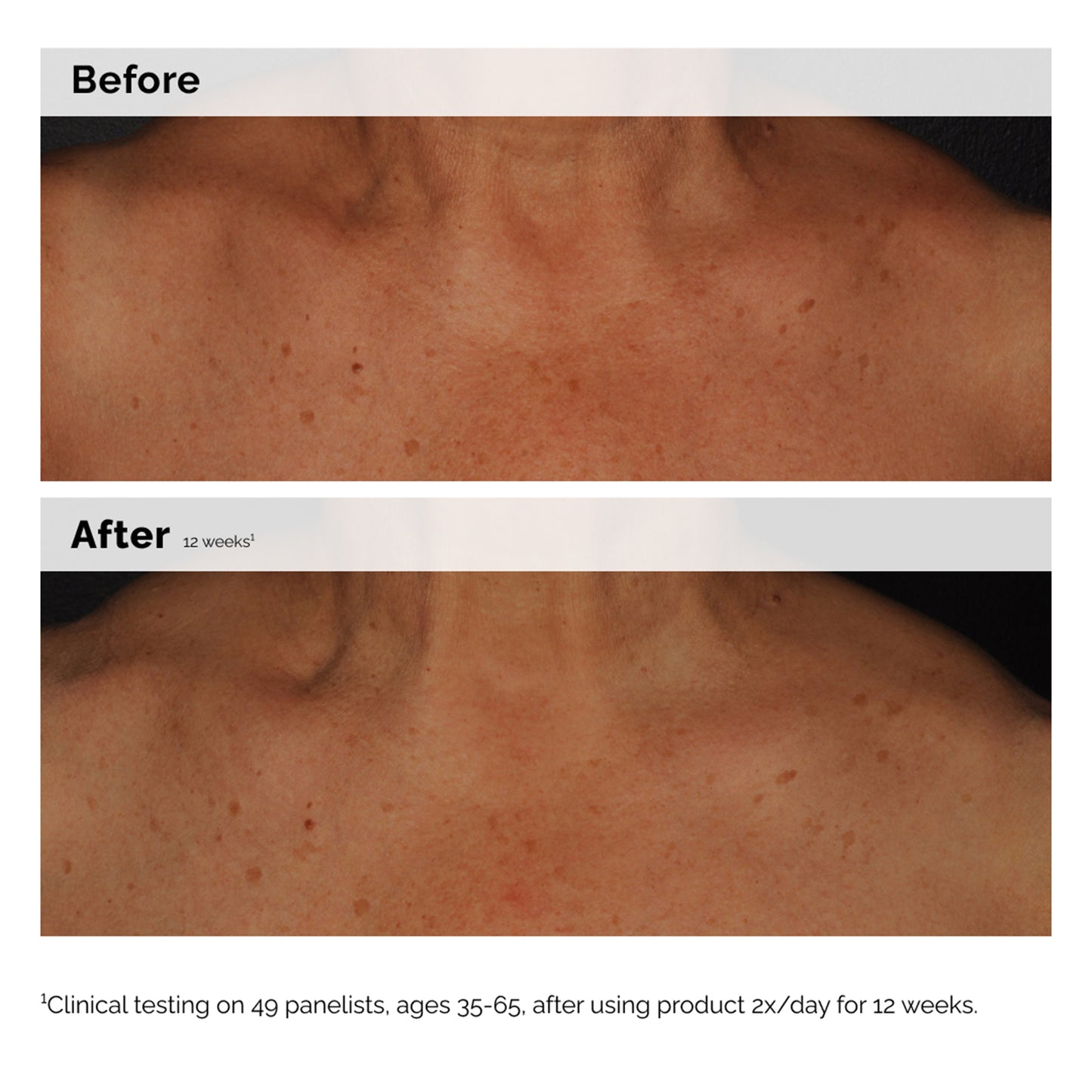 The Ordinary Niacinamide 5% Face and Body Emulsion 100ml