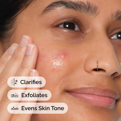 The Ordinary Salicylic Acid 2% Anhydrous Solution 30ml