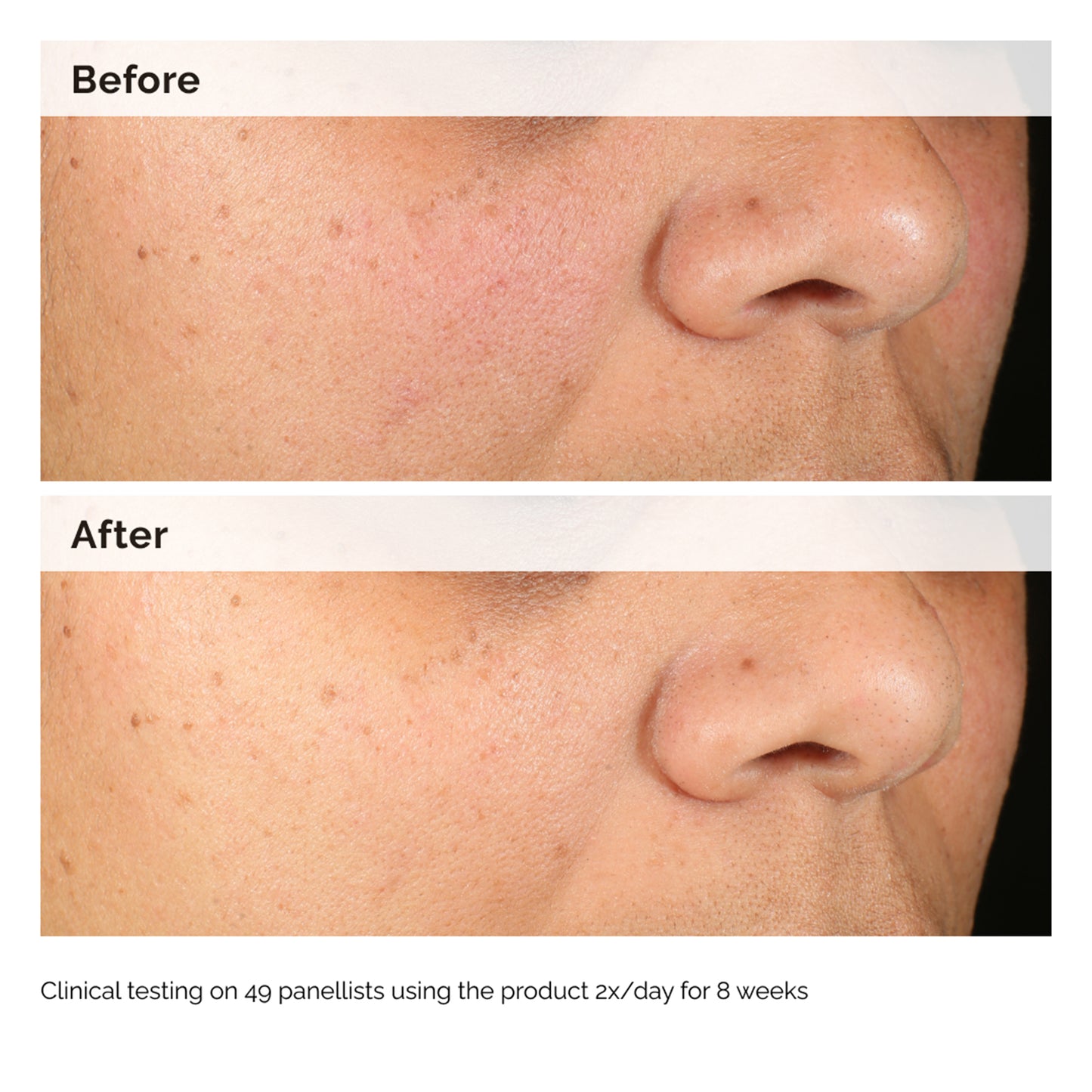 The Ordinary Alpha Arbutin 2% + HA 30ml