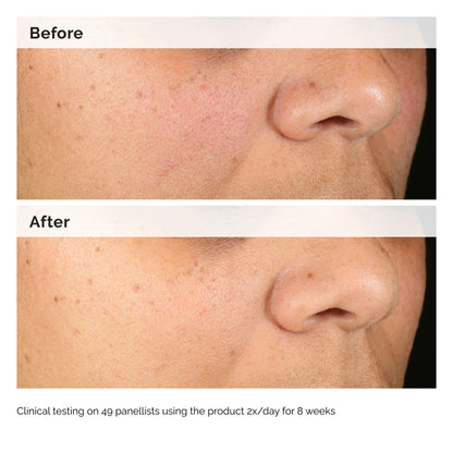 The Ordinary Alpha Arbutin 2% + HA 60ml