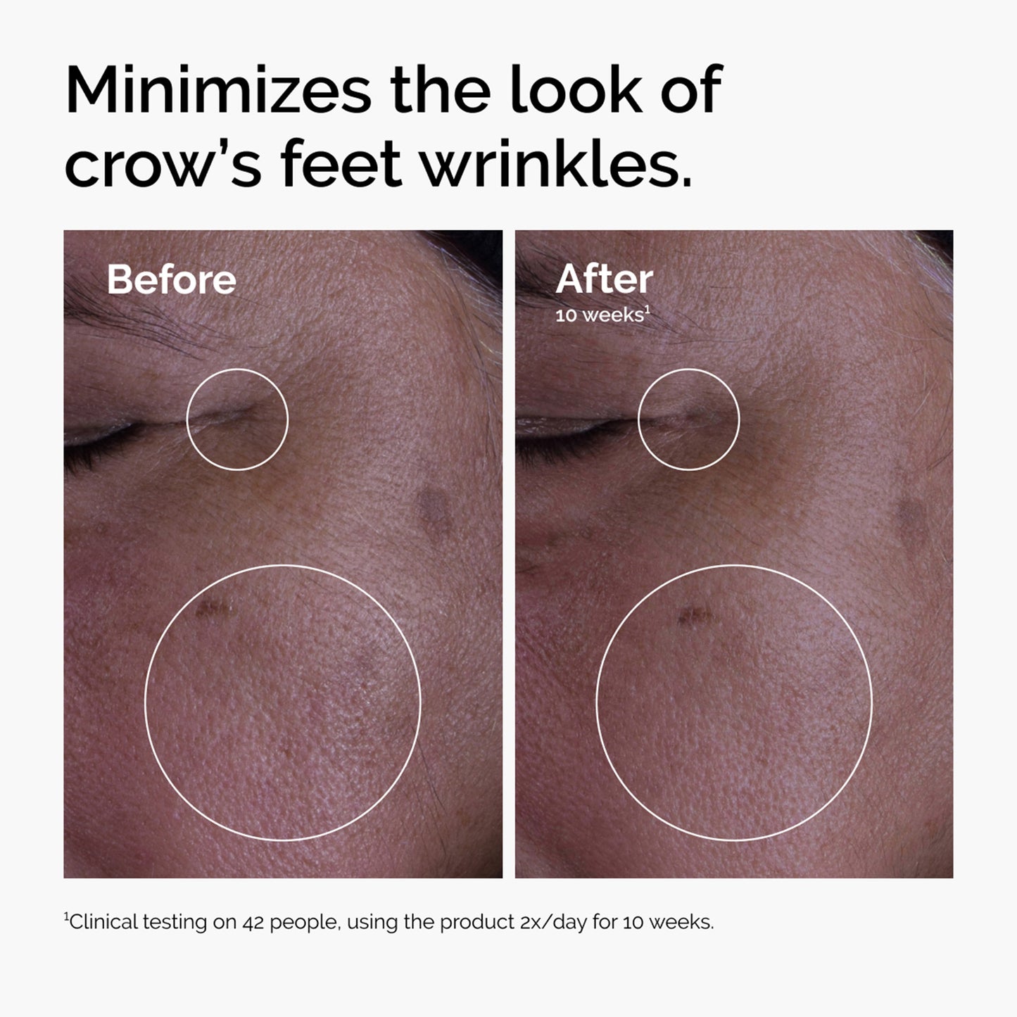 The Ordinary GF 15% Solution 30ml