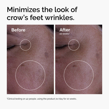 The Ordinary GF 15% Solution 30ml