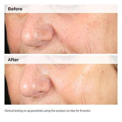 The Ordinary Alpha Arbutin 2% + HA 60ml