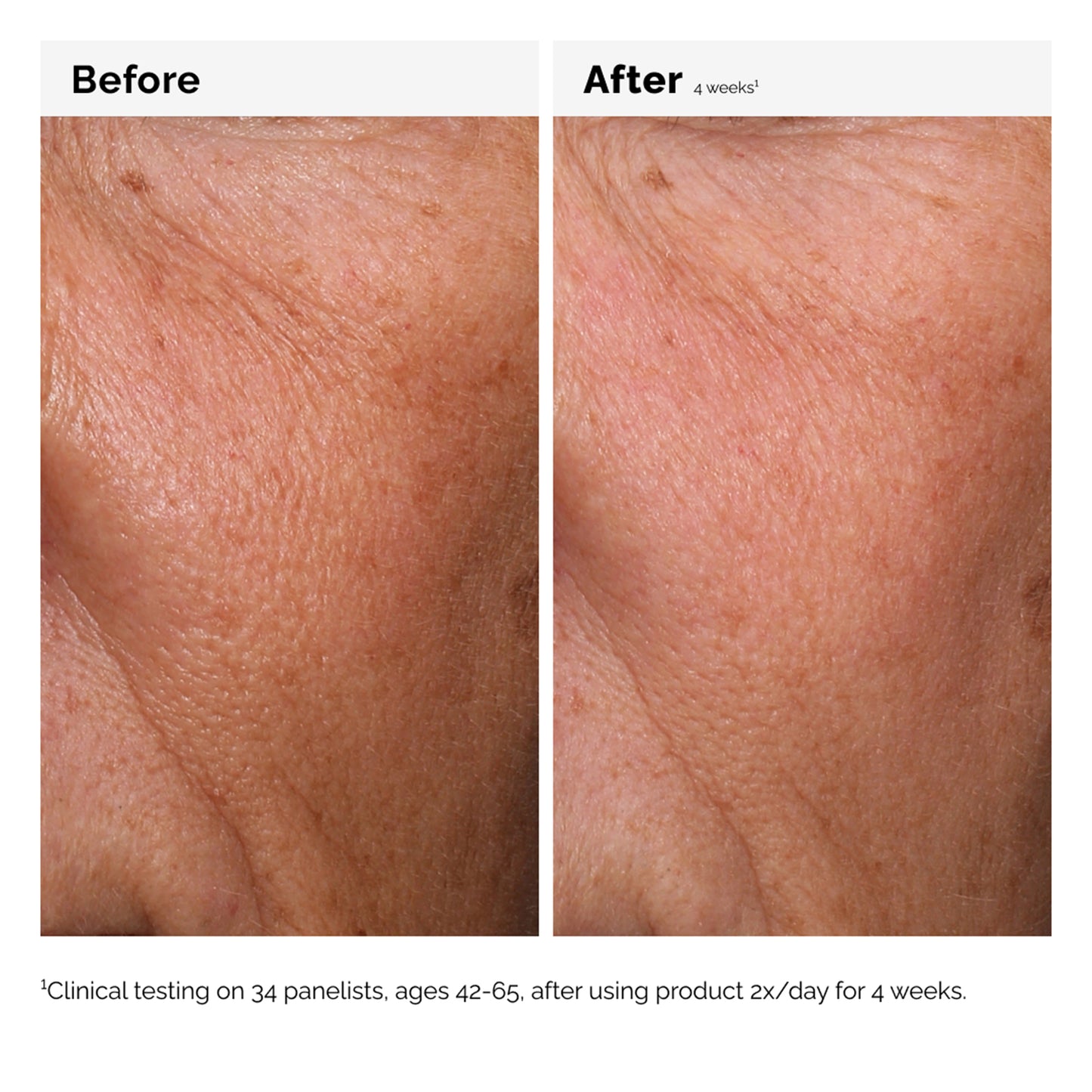 The Ordinary Hyaluronic Acid 2% + B5 30ml