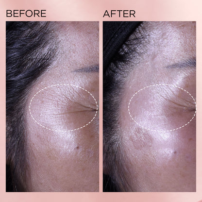 Elizabeth Arden Retinol + HPR Ceramide Capsules Rapid Skin Renewing Serum 90 Piece