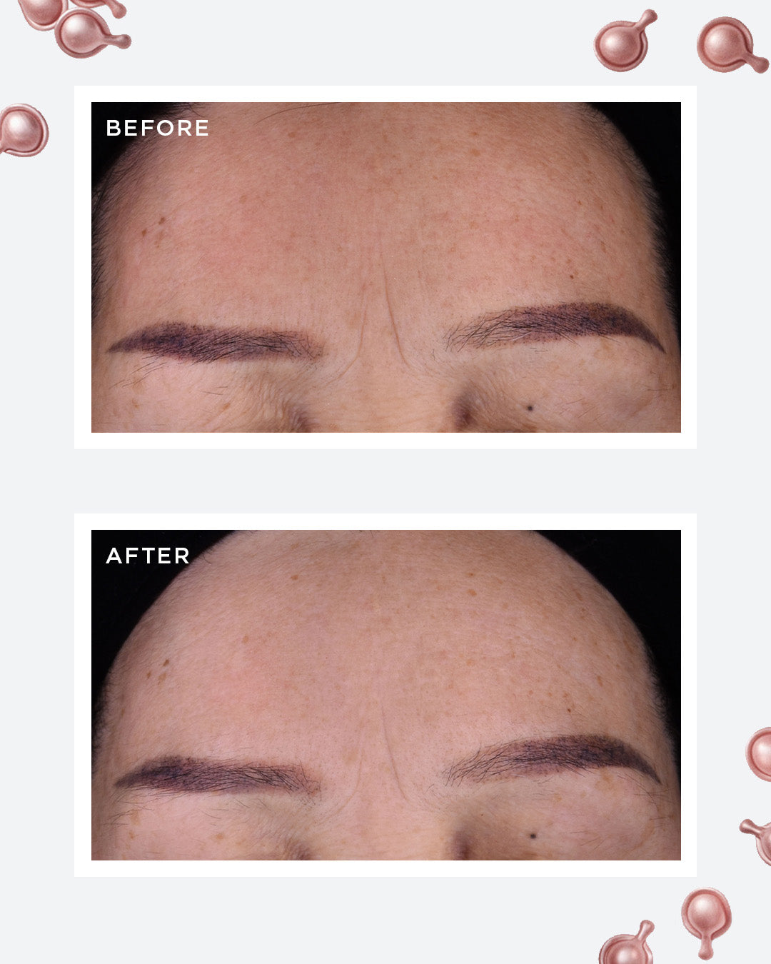 Elizabeth Arden Retinol + HPR Ceramide Capsules Rapid Skin Renewing Serum 90 Piece