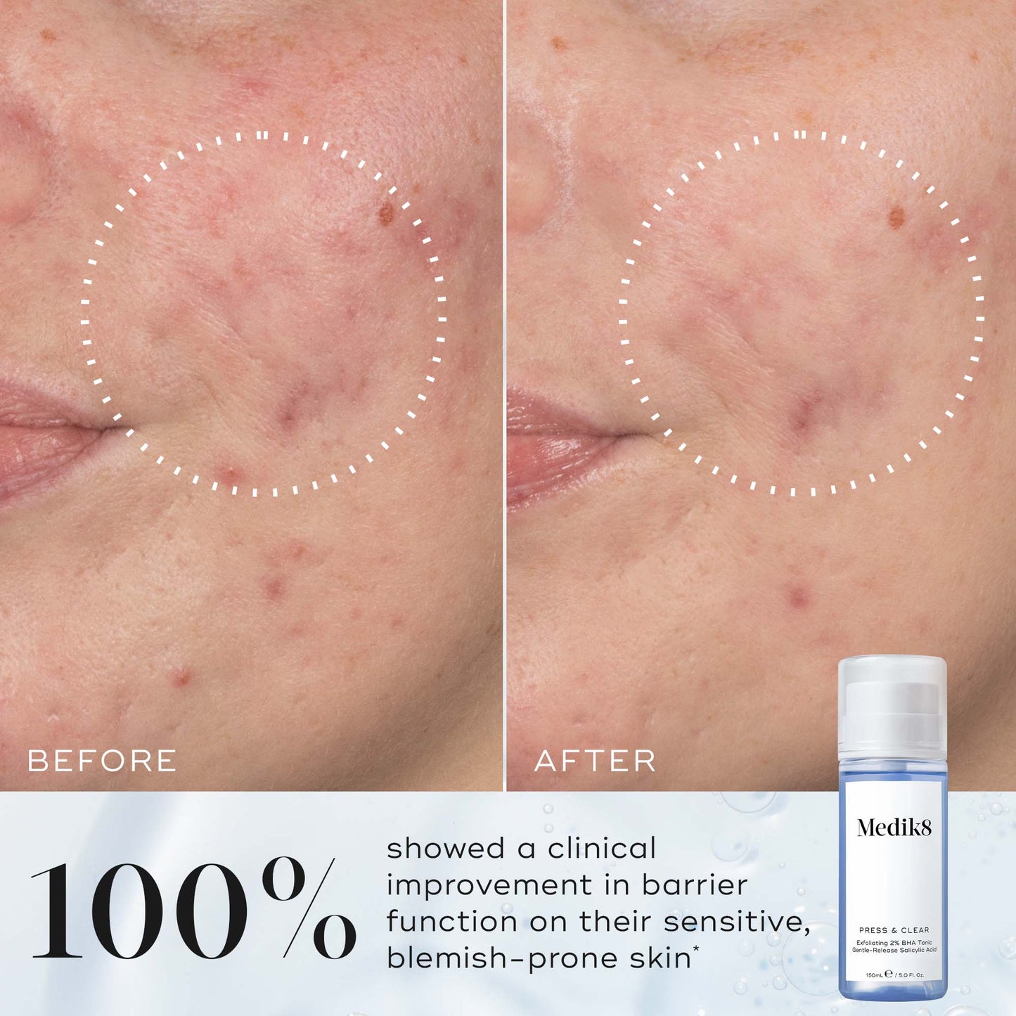 Medik8 Press and Clear Refill 150ml