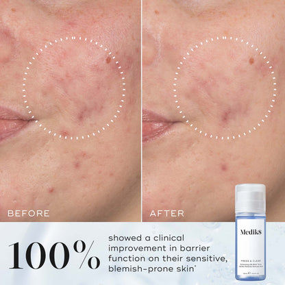 Medik8 Press and Clear Refill 150ml