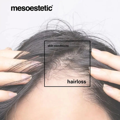 Mesoestetic Tricology Loss Shampoo 225ml