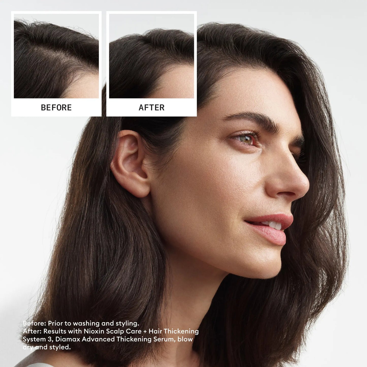 Nioxin Scalp + Hair Thickening System 3 Trial Kit