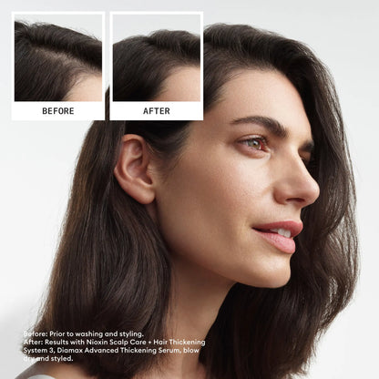Nioxin Scalp + Hair Thickening System 3 Trial Kit