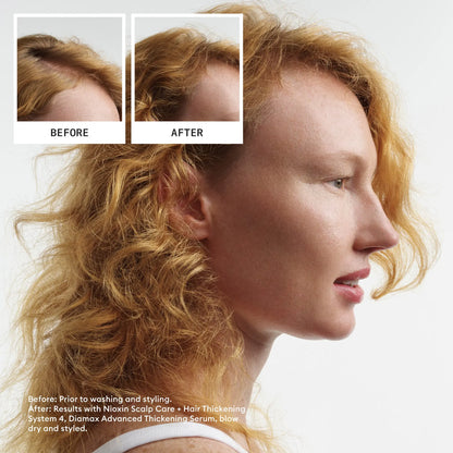 Nioxin Scalp + Hair Thickening System 4 Trial Kit