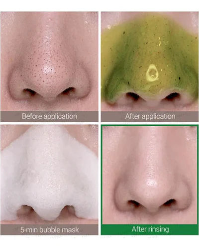 SOME BY MI Miracle Bye Bye 30 Days Blackhead Miracle Green Tea Tox Bubble Cleanser 120g